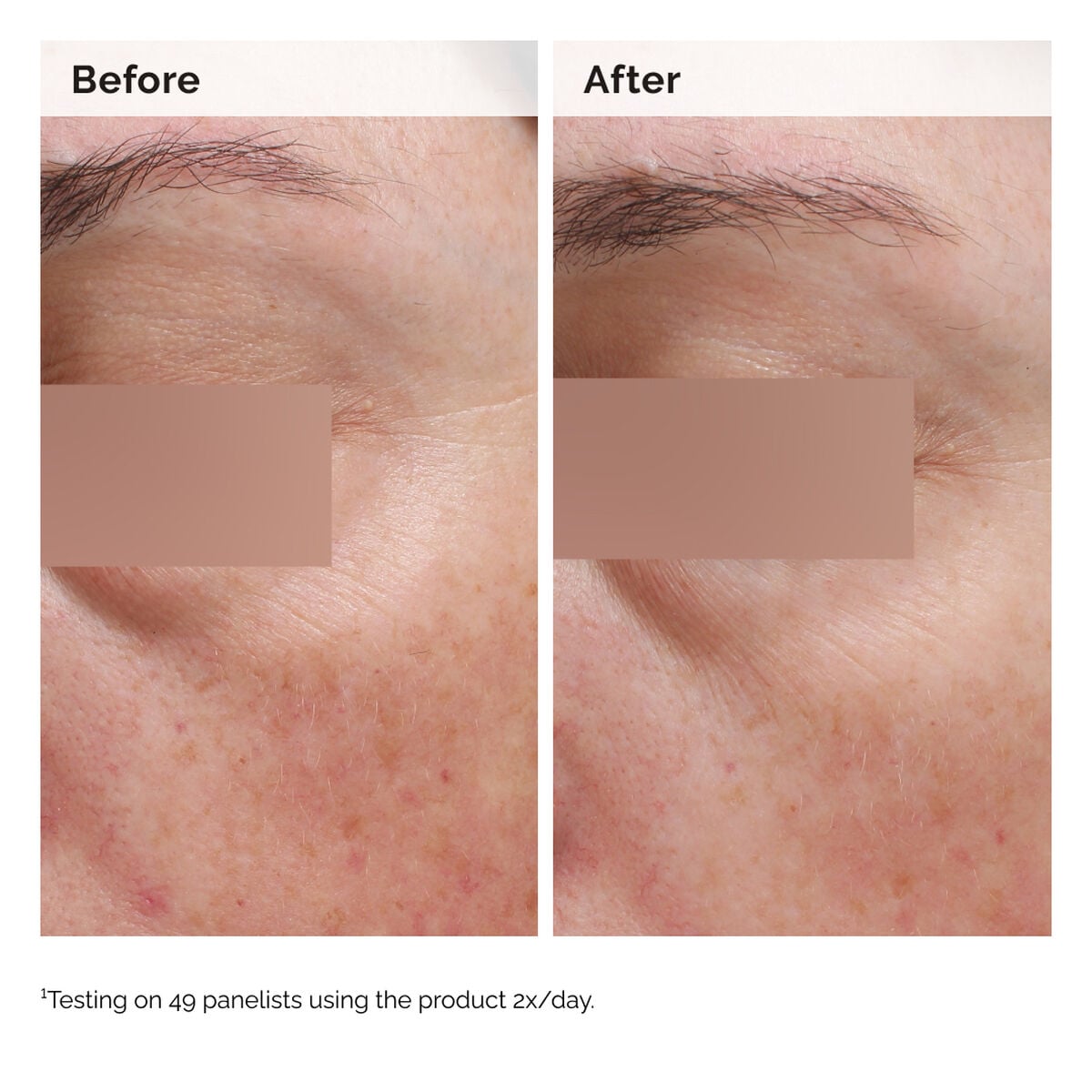 niacinamide-5-face-and-body-emulsion-s3 2024-08-23-ORD-Nia-5pct-Face-Body-B-A-Elasticity-Global-02-1x1.jpg