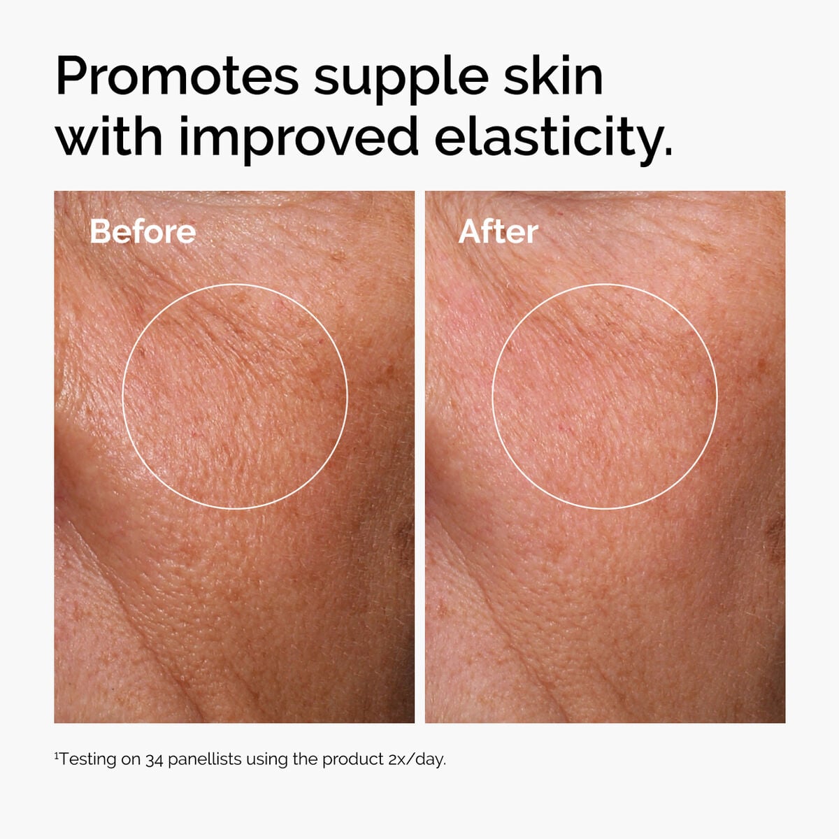 hyaluronic-acid-2-b5-with-ceramides-c7 ord-hyaluronic-acid-2pct-b5-hydrating-serum-before-after-elasticity.jpg