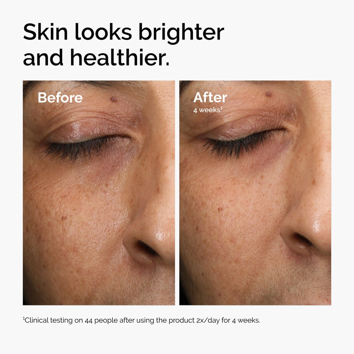 multi-antioxidant-radiance-serum-t5 ord-mars-before-after-healthy.jpg