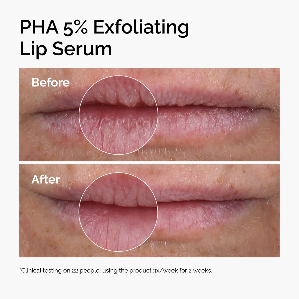 pha-5-exfoliating-lip-serum-i7 ord-pha-5pct-lip-exfoliating-serum-before-after.jpg